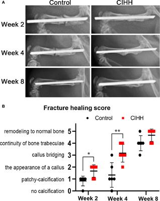 Chronic Intermittent Hypobaric Hypoxia Enhances Bone Fracture Healing